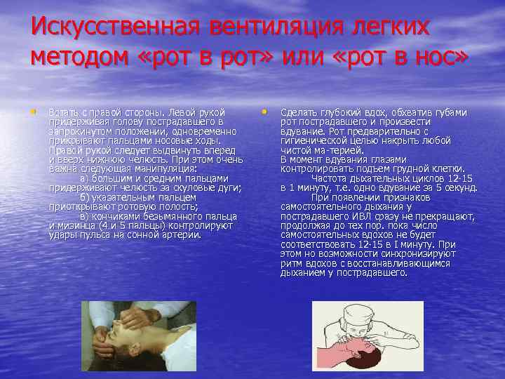 Искусственная вентиляция легких методом «рот в рот» или «рот в нос» • Встать с
