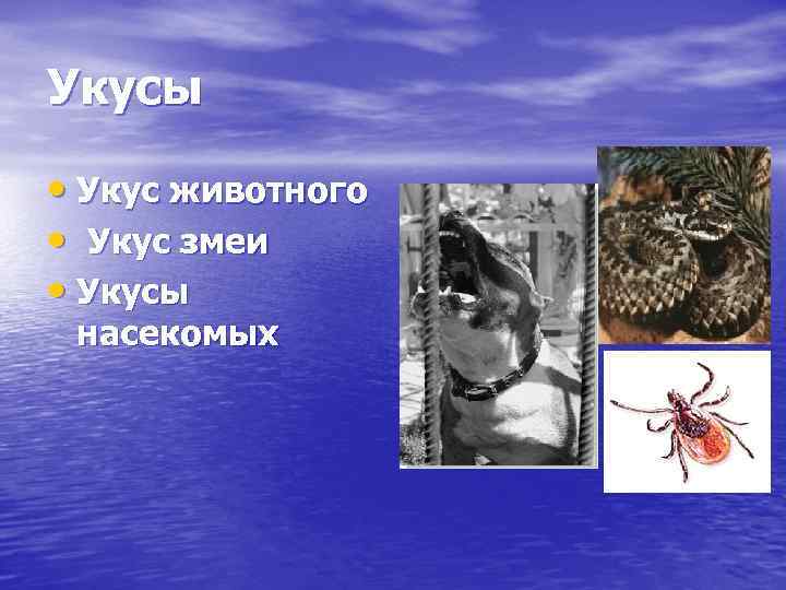 Укусы • Укус животного • Укус змеи • Укусы насекомых 