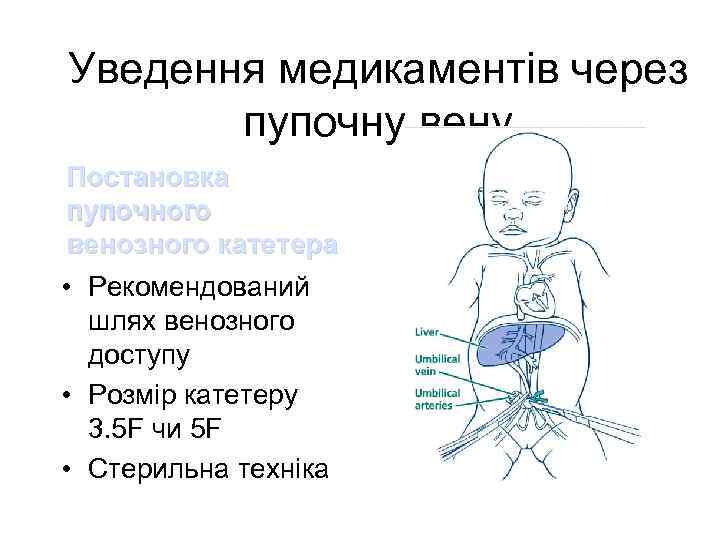 Уведення медикаментів через пупочну вену Постановка пупочного венозного катетера • Рекомендований шлях венозного доступу