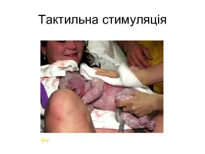 Taктильна стимуляція 