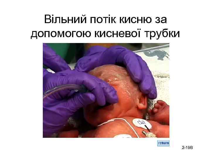 Вільний потік кисню за допомогою кисневої трубки 2 -19 B 