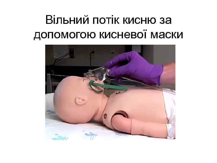 Вільний потік кисню за допомогою кисневої маски 