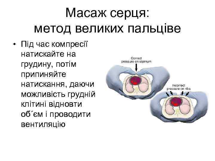 Масаж серця: метод великих пальцівe • Під час компресії натискайте на грудину, потім припиняйте
