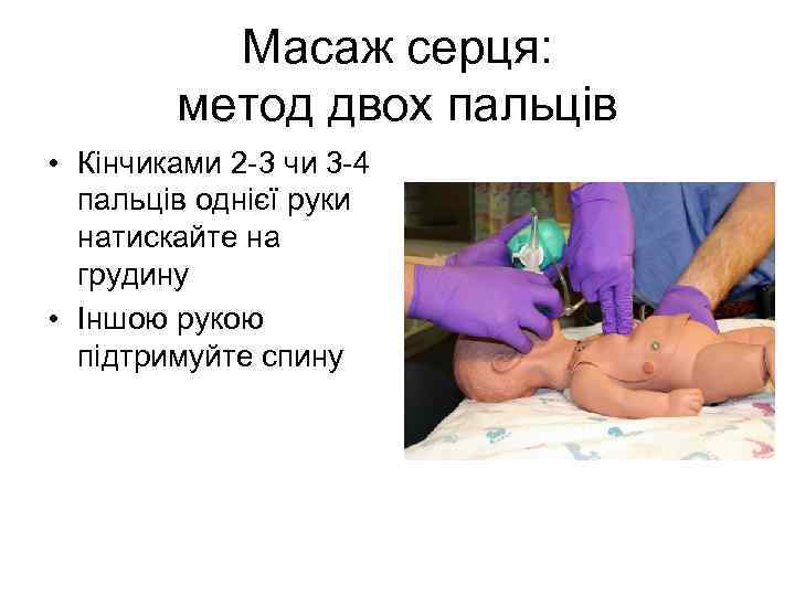 Масаж серця: метод двох пальців • Кінчиками 2 -3 чи 3 -4 пальців однієї