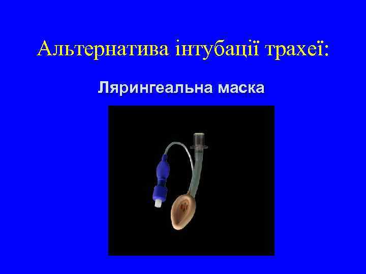 Альтернатива інтубації трахеї: Лярингеальна маска 