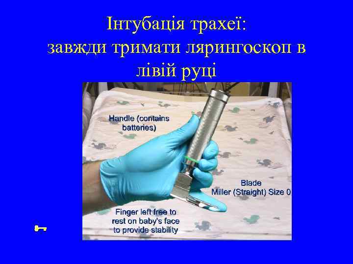 Інтубація трахеї: завжди тримати лярингоскоп в лівій руці 