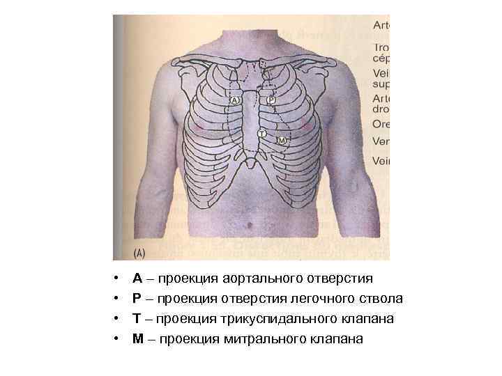  • • А – проекция аортального отверстия Р – проекция отверстия легочного ствола