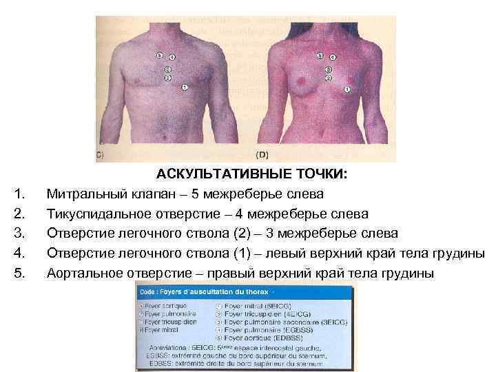 1. 2. 3. 4. 5. АСКУЛЬТАТИВНЫЕ ТОЧКИ: Митральный клапан – 5 межреберье слева Тикуспидальное