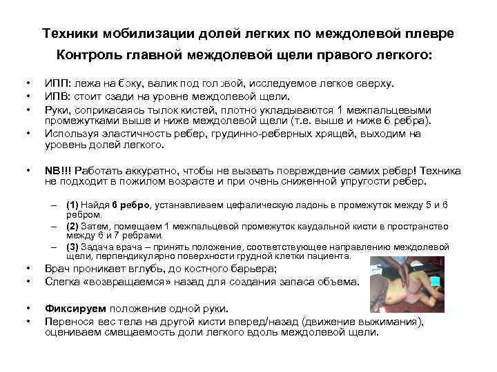 Техники мобилизации долей легких по междолевой плевре Контроль главной междолевой щели правого легкого: •