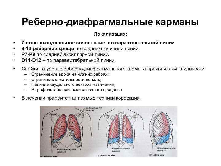 Реберно-диафрагмальные карманы Локализация: • • 7 стернохондральное сочленение по парастернальной линии 8 -10 реберные