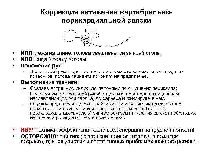 Коррекция натяжения вертебральноперикардиальной связки • • • ИПП: лежа на спине, голова свешивается за