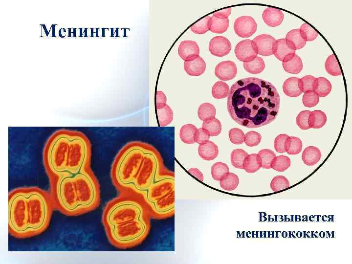 Менингококки микробиология. Менингококки форма клетки. Менингококки микробиология рисунок.