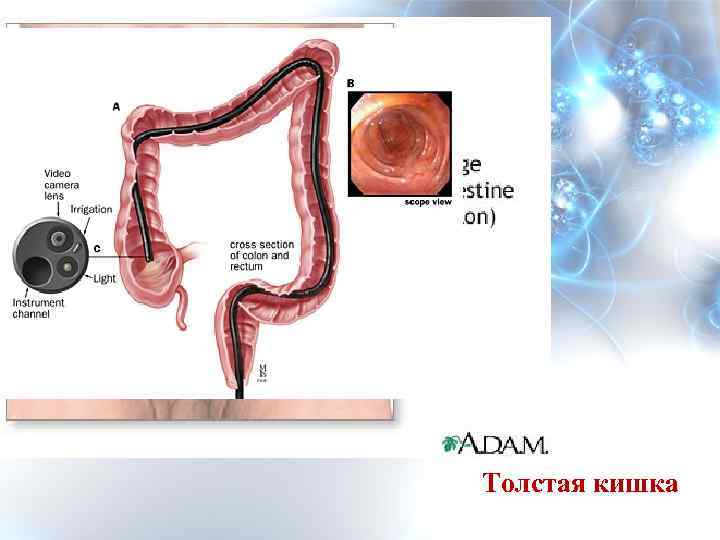 Толстая кишка 
