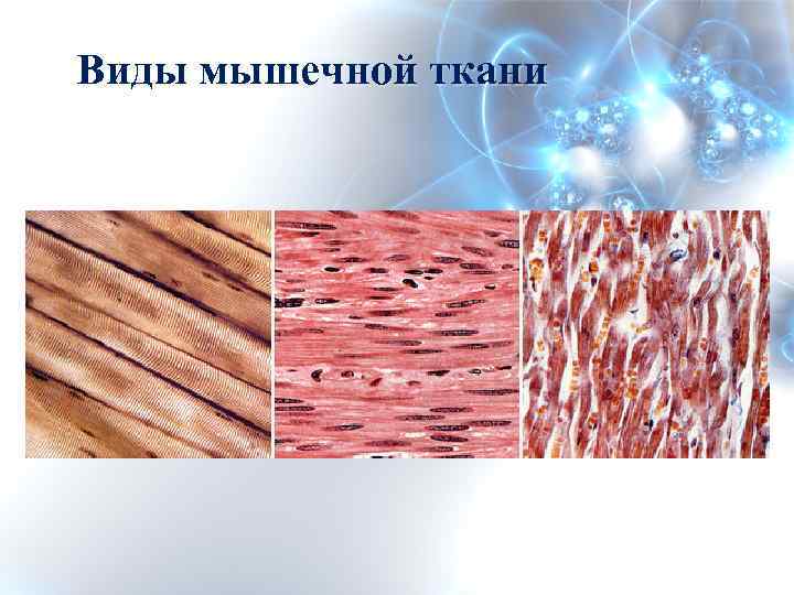 Особенности строения мышечной ткани ответ. Мышечная ткань. Строение мышечной ткани. Строение мышечной ткани человека. Мышечная ткань ткань.