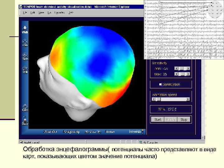 Обработка энцефалограммы( потенциалы часто представляют в виде карт, показывающих цветом значение потенциала) 