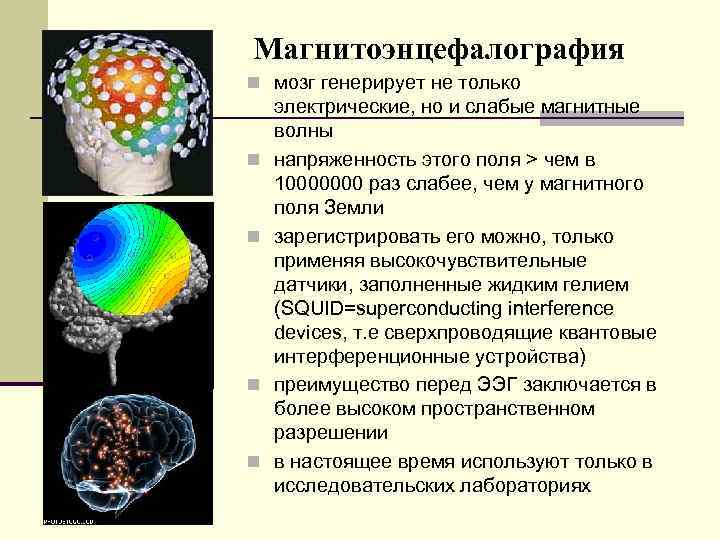 Магнитоэнцефалография n мозг генерирует не только n n электрические, но и слабые магнитные волны