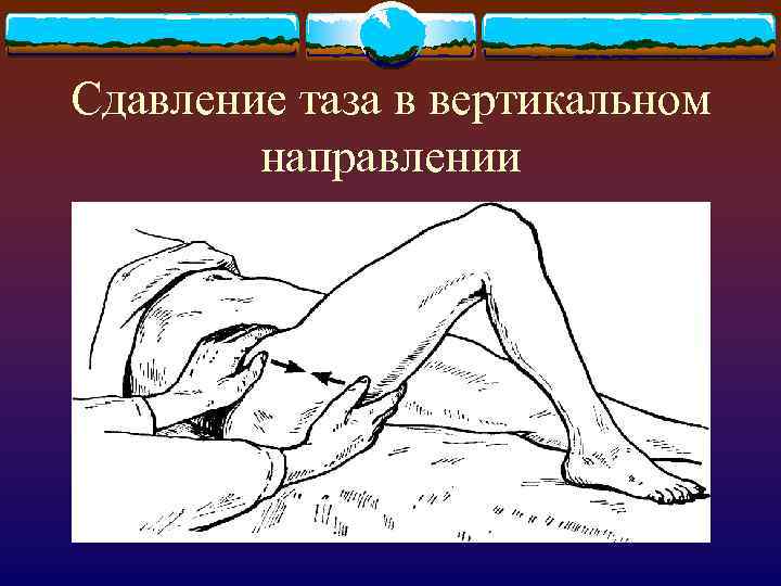Сдавление таза в вертикальном направлении 