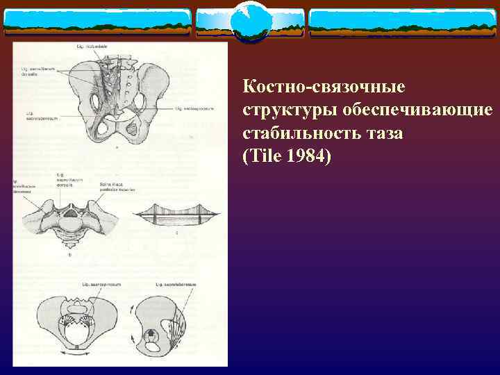 Костно-связочные структуры обеспечивающие стабильность таза (Tile 1984) 