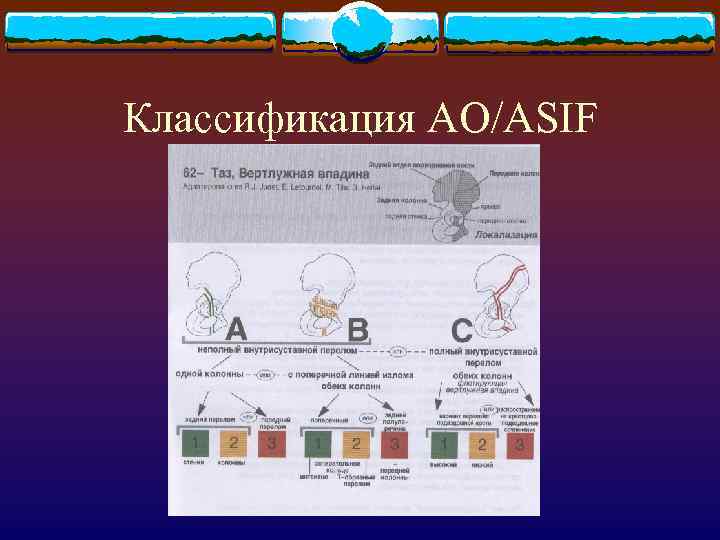 Классификация AO/ASIF 