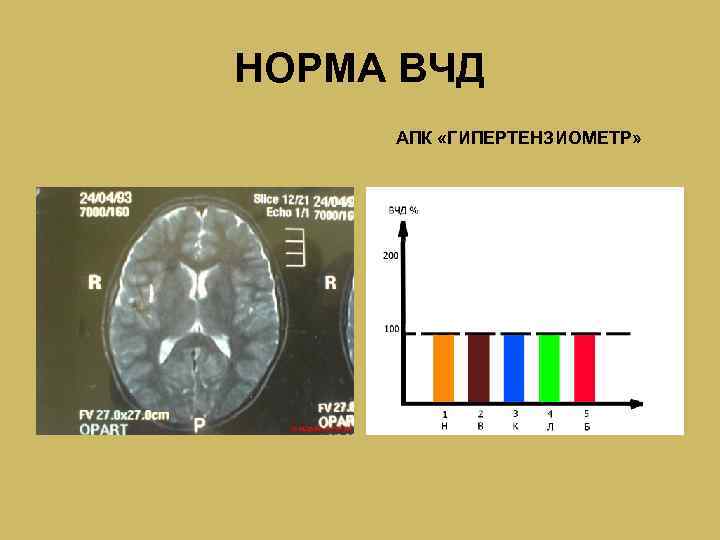 НОРМА ВЧД АПК «ГИПЕРТЕНЗИОМЕТР» 