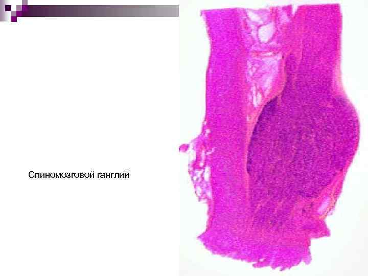 Спиномозговой ганглий 