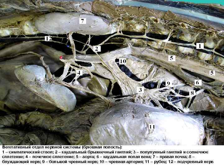 Вегетативный отдел нервной системы (брюшная полость): 1 – симпатический ствол; 2 – каудальный брыжеечный