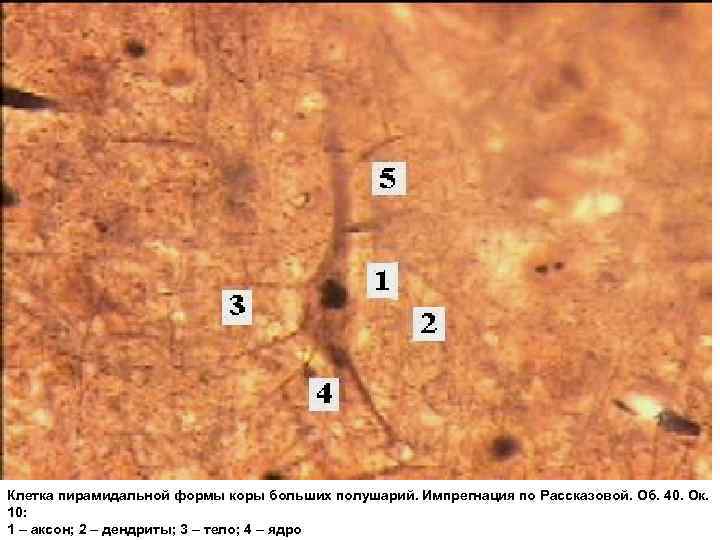 Клетка пирамидальной формы коры больших полушарий. Импрегнация по Рассказовой. Об. 40. Ок. 10: 1
