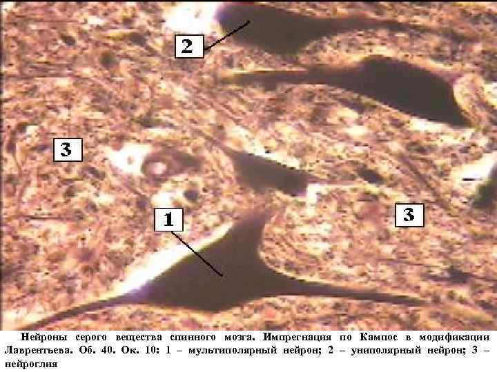 Нейроны спинного мозга. Мультиполярные Нейроны спинного мозга препарат. Мультиполярные Нейроны спинного мозга гистология препарат. Мультиполярный Нейрон препарат. Мультиполярные нервные клетки спинного мозга гистология.