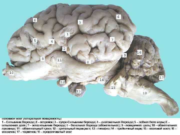 Головной мозг (латеральная поверхность): 1 – Сильвиева борозда; 2 – островок; 3 – супра-Сильвиева