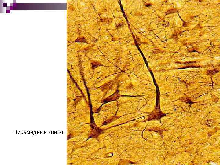 Пирамидные клетки 