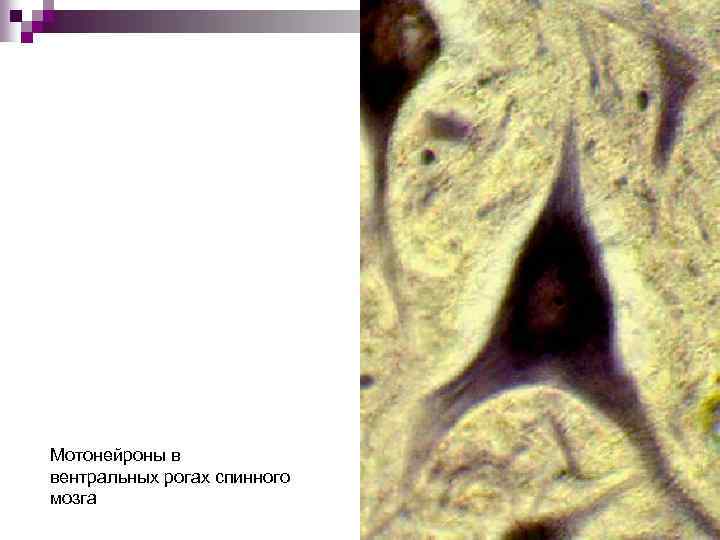 Мотонейроны в вентральных рогах спинного мозга 