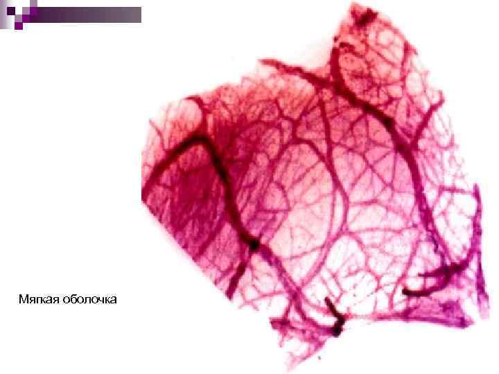 Мягкая оболочка 