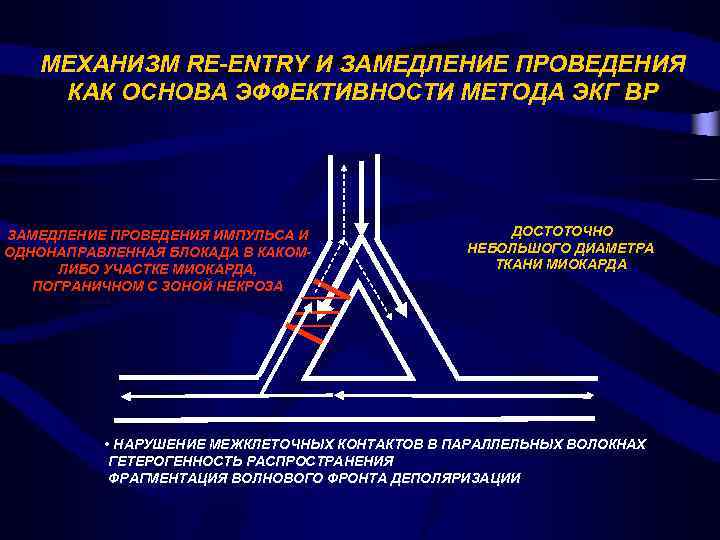 МЕХАНИЗМ RE-ENTRY И ЗАМЕДЛЕНИЕ ПРОВЕДЕНИЯ КАК ОСНОВА ЭФФЕКТИВНОСТИ МЕТОДА ЭКГ ВР ЗАМЕДЛЕНИЕ ПРОВЕДЕНИЯ ИМПУЛЬСА