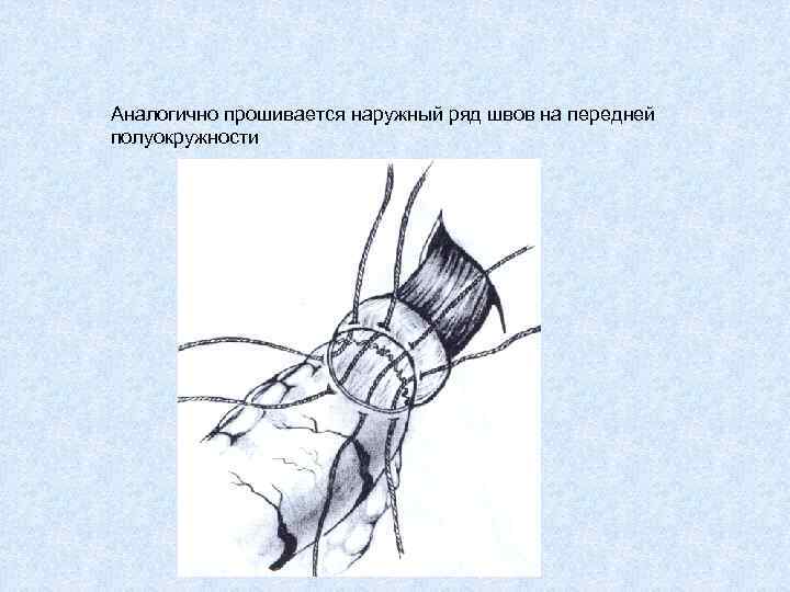 Аналогично прошивается наружный ряд швов на передней полуокружности 