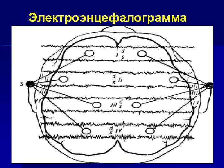 Электроэнцефалограмма 