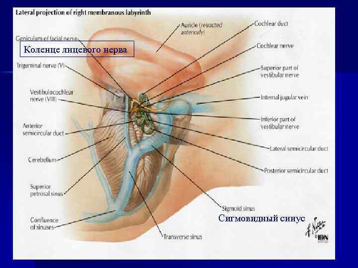 Коленце лицевого нерва Сигмовидный синус 