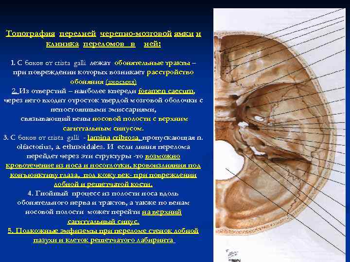 Топография передней черепно-мозговой ямки и клиника переломов в ней: 1. С боков от crista