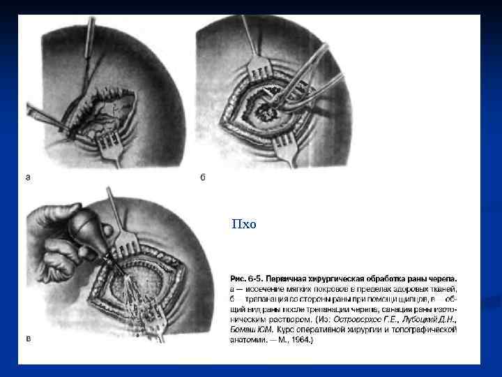 Пхо непроникающих ран свода черепа 
