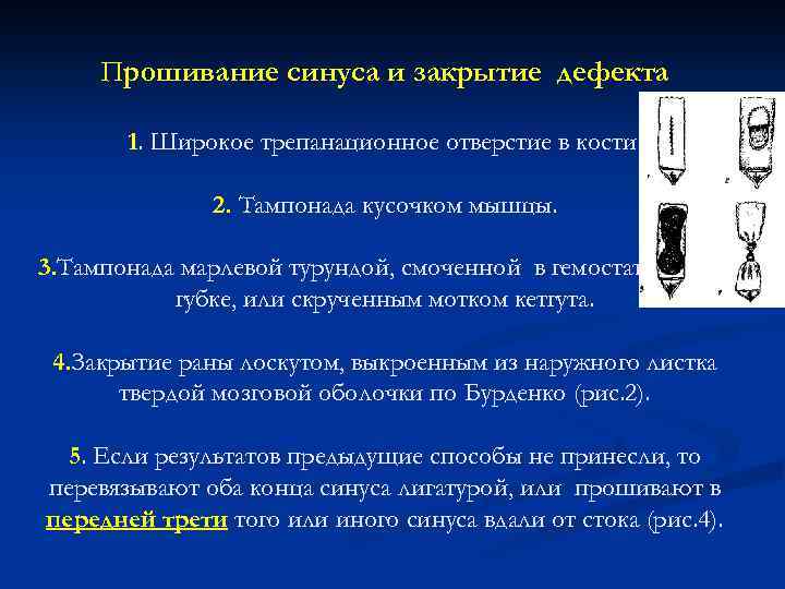 Прошивание синуса и закрытие дефекта 1. Широкое трепанационное отверстие в кости. 2. Тампонада кусочком