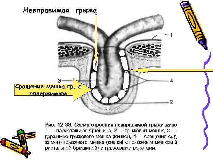 Фото межъягодичная зона