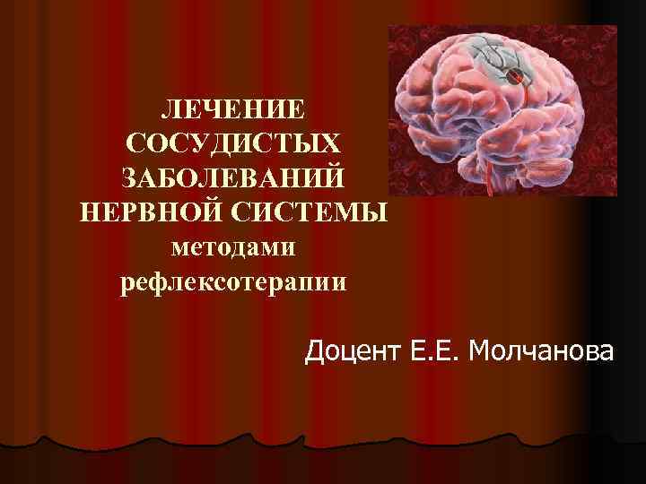 ЛЕЧЕНИЕ СОСУДИСТЫХ ЗАБОЛЕВАНИЙ НЕРВНОЙ СИСТЕМЫ методами рефлексотерапии Доцент Е. Е. Молчанова 