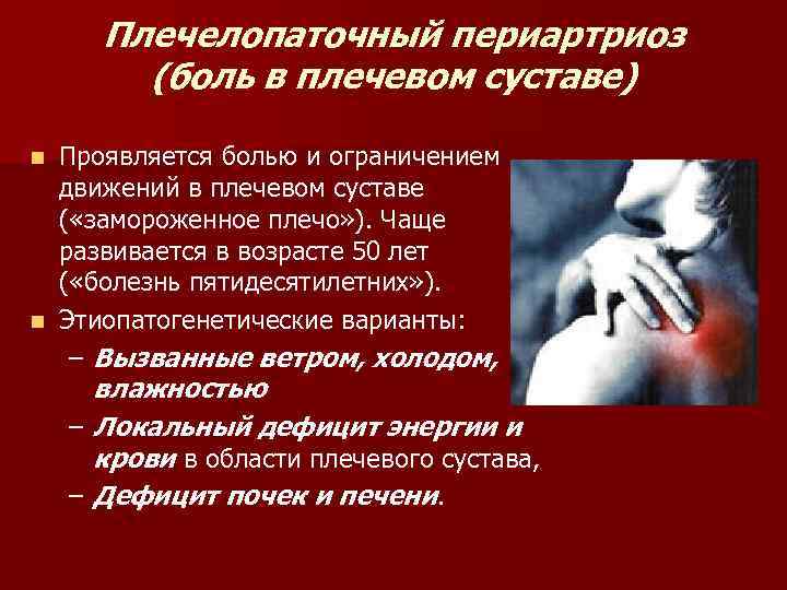 Плечелопаточный периартриоз (боль в плечевом суставе) Проявляется болью и ограничением движений в плечевом суставе