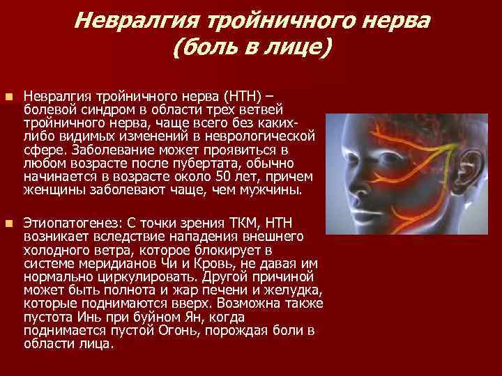 Невралгия тройничного нерва (боль в лице) n Невралгия тройничного нерва (НТН) – болевой синдром
