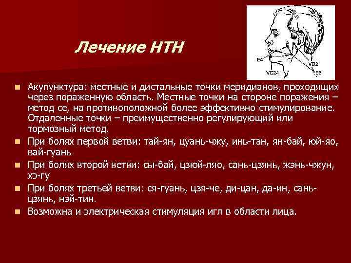 Лечение НТН n n n Акупунктура: местные и дистальные точки меридианов, проходящих через пораженную