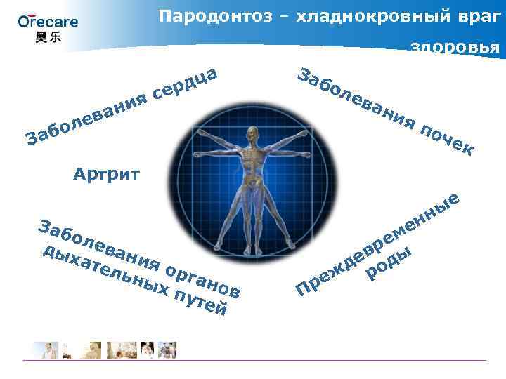 Пародонтоз – хладнокровный враг здоровья дца ер ева ол яс ни За бо Заб