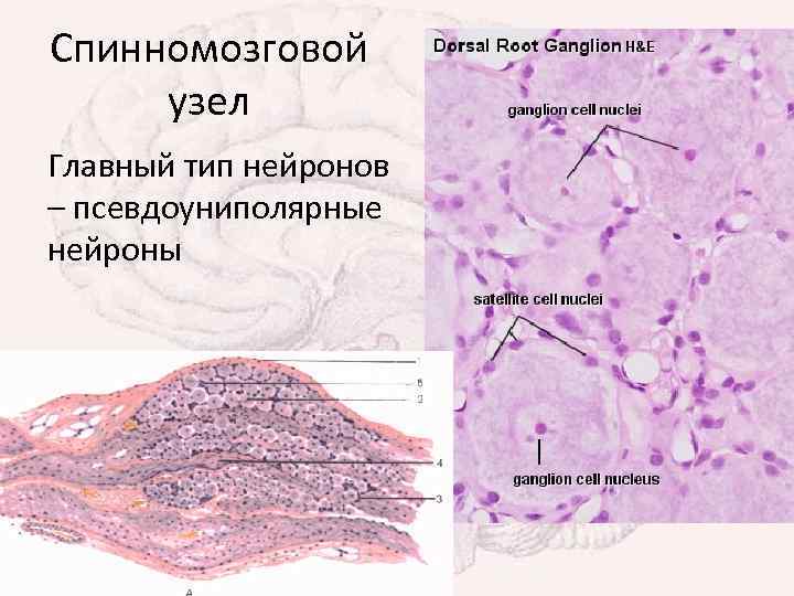 Спинномозговой узел Главный тип нейронов – псевдоуниполярные нейроны 