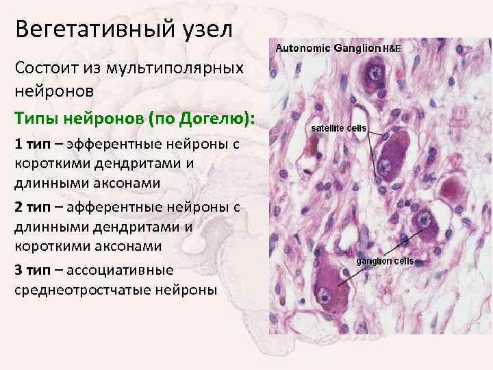 Вегетативный узел Состоит из мультиполярных нейронов Типы нейронов (по Догелю): 1 тип – эфферентные