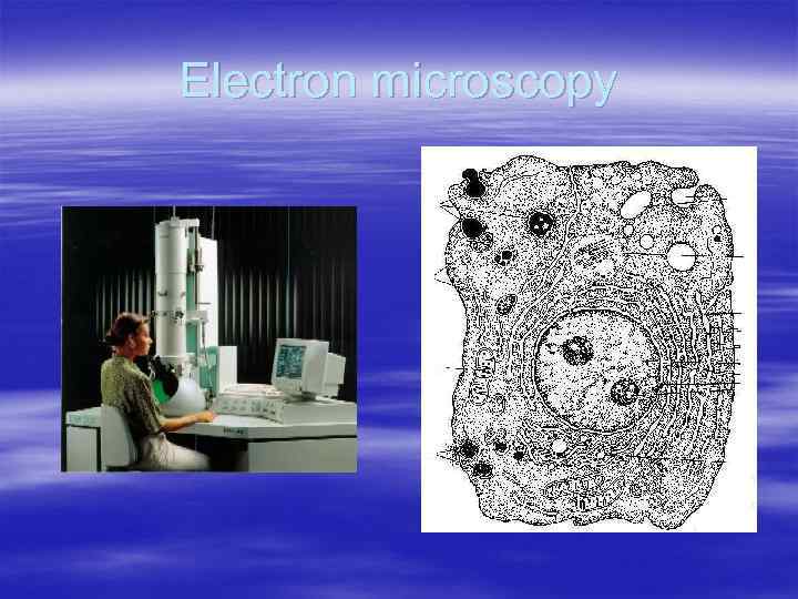 Electron microscopy 