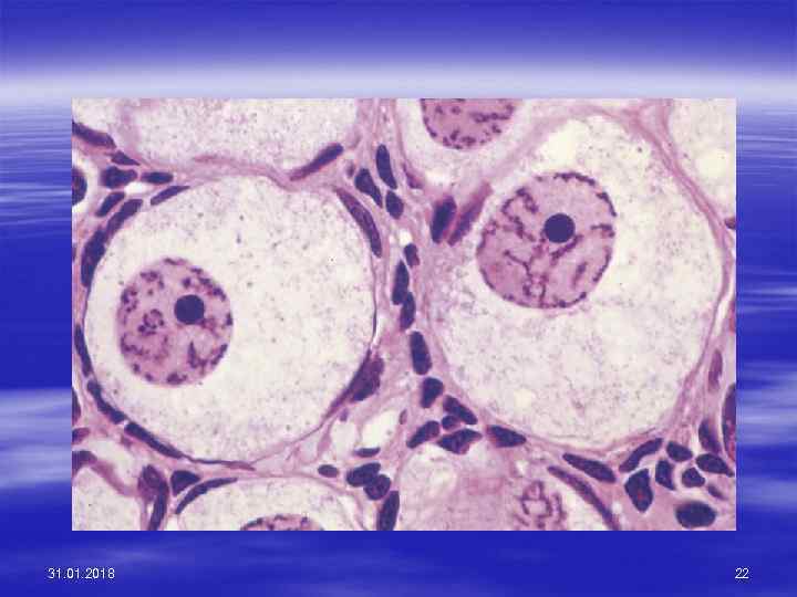31. 01. 2018 22 