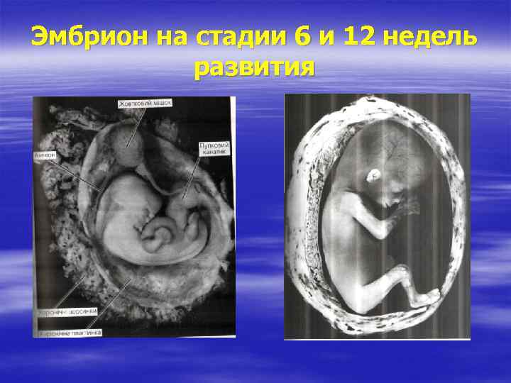 Эмбрион на стадии 6 и 12 недель развития 